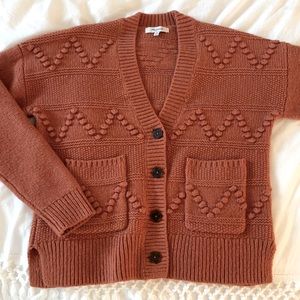 Madewell “Zigzag Bobble Cardigan Sweater”